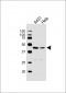 LEFTY2 Antibody